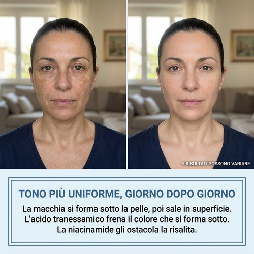 NeutraLab™ Crema Antimacchie Viso, Mani e Corpo
